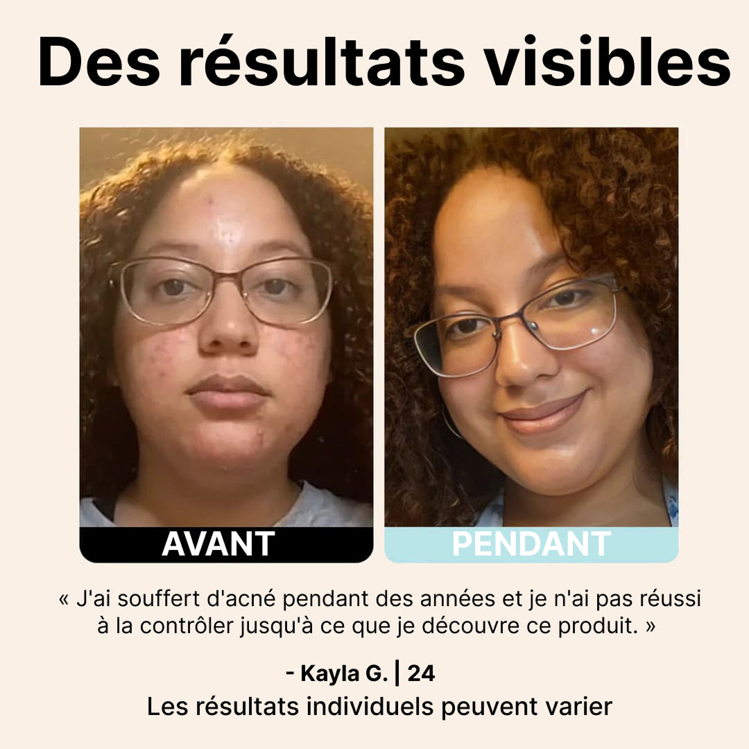 MorsBeau